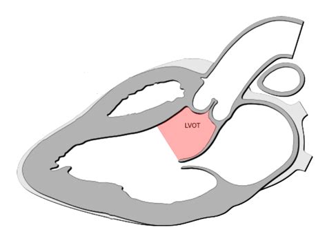 left ventricular outflow tract.